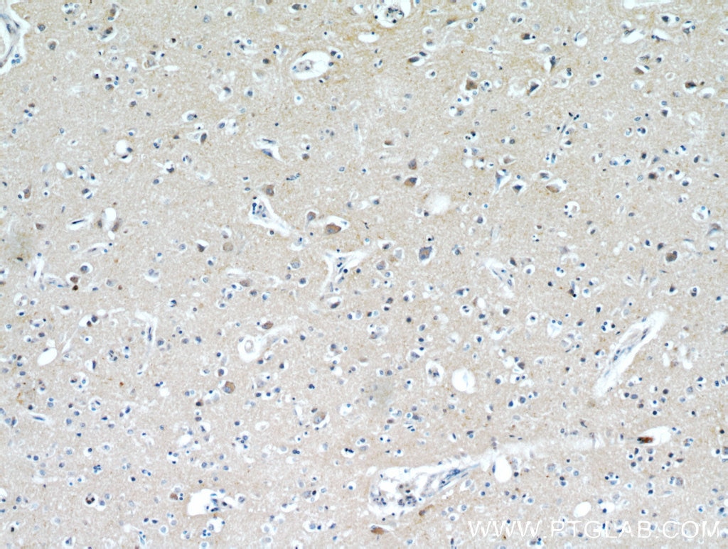 Immunohistochemistry (IHC) staining of human brain tissue using HAPLN4 Polyclonal antibody (21228-1-AP)