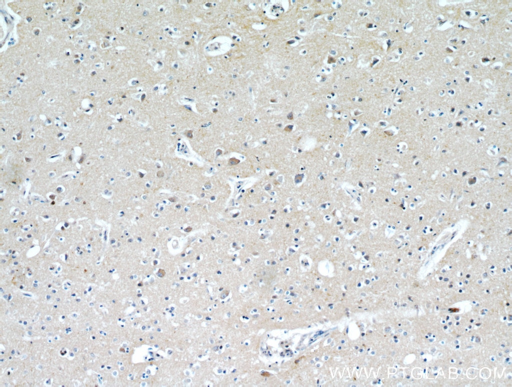 IHC staining of human brain using 21228-1-AP