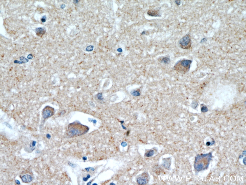 Immunohistochemistry (IHC) staining of human brain tissue using HAPLN4 Polyclonal antibody (21228-1-AP)