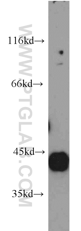 Western Blot (WB) analysis of mouse brain tissue using HAPLN4 Polyclonal antibody (21228-1-AP)
