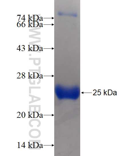 HAPLN4 fusion protein Ag15945 SDS-PAGE