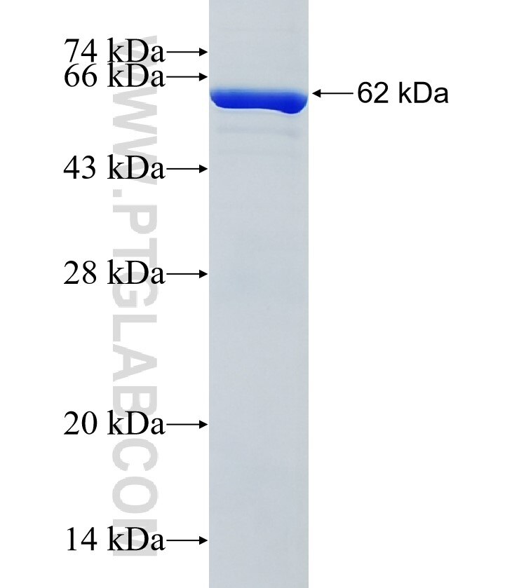 HARBI1 fusion protein Ag34137 SDS-PAGE