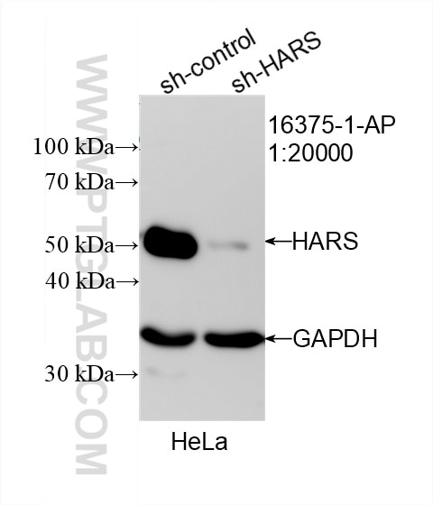 Western Blot (WB) analysis of HeLa cells using HARS Polyclonal antibody (16375-1-AP)