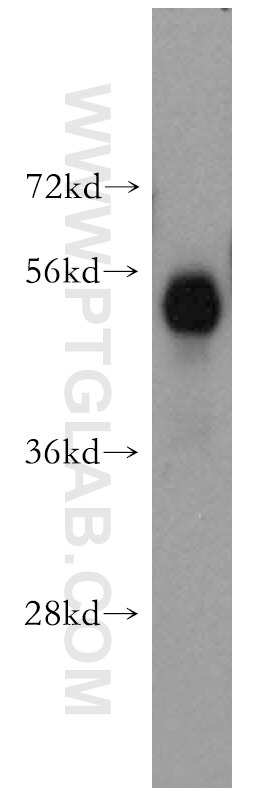 WB analysis of mouse brain using 16375-1-AP