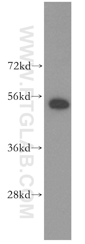 Western Blot (WB) analysis of human kidney tissue using HARS Polyclonal antibody (16375-1-AP)