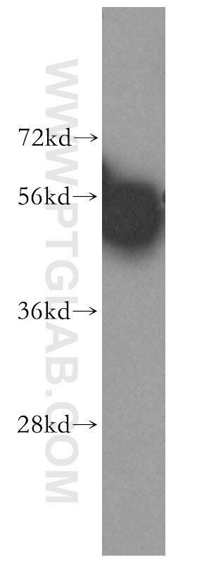 Western Blot (WB) analysis of HeLa cells using HARS Polyclonal antibody (16375-1-AP)