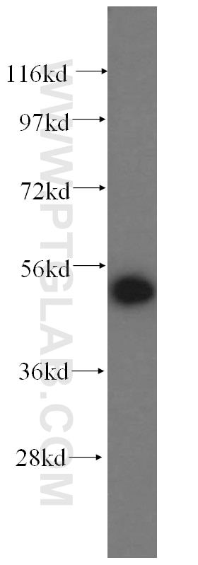 Western Blot (WB) analysis of mouse heart tissue using HARS Polyclonal antibody (16375-1-AP)