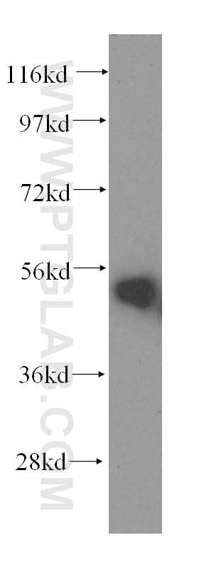 Western Blot (WB) analysis of mouse lung tissue using HARS Polyclonal antibody (16375-1-AP)
