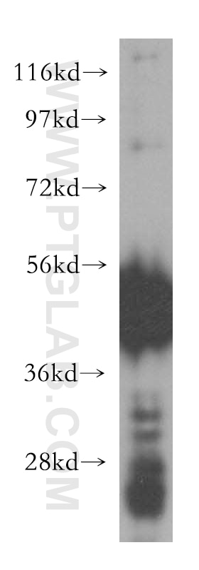 Western Blot (WB) analysis of K-562 cells using HARS Polyclonal antibody (16375-1-AP)