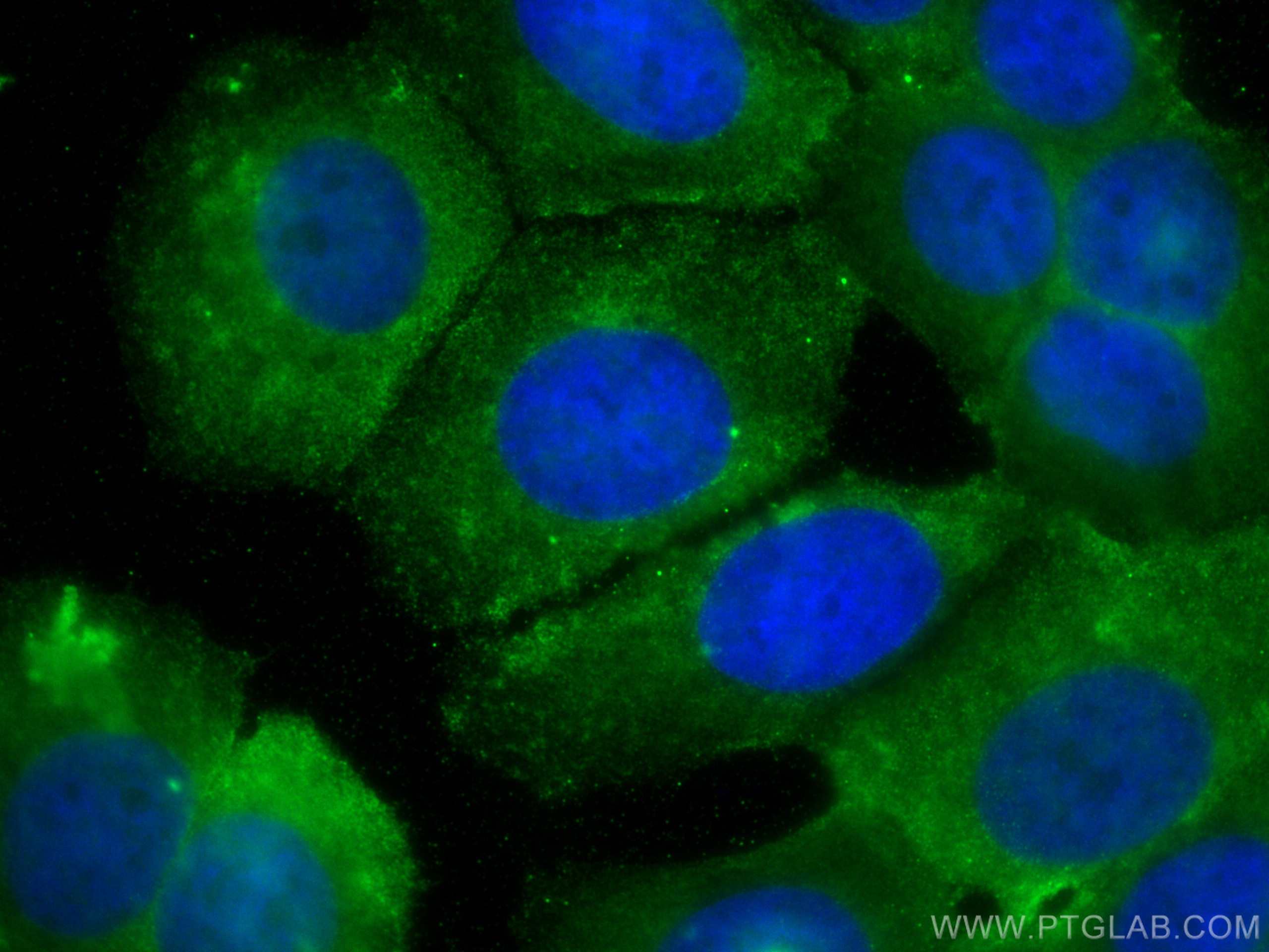 Immunofluorescence (IF) / fluorescent staining of MCF-7 cells using HARS Monoclonal antibody (67662-1-Ig)
