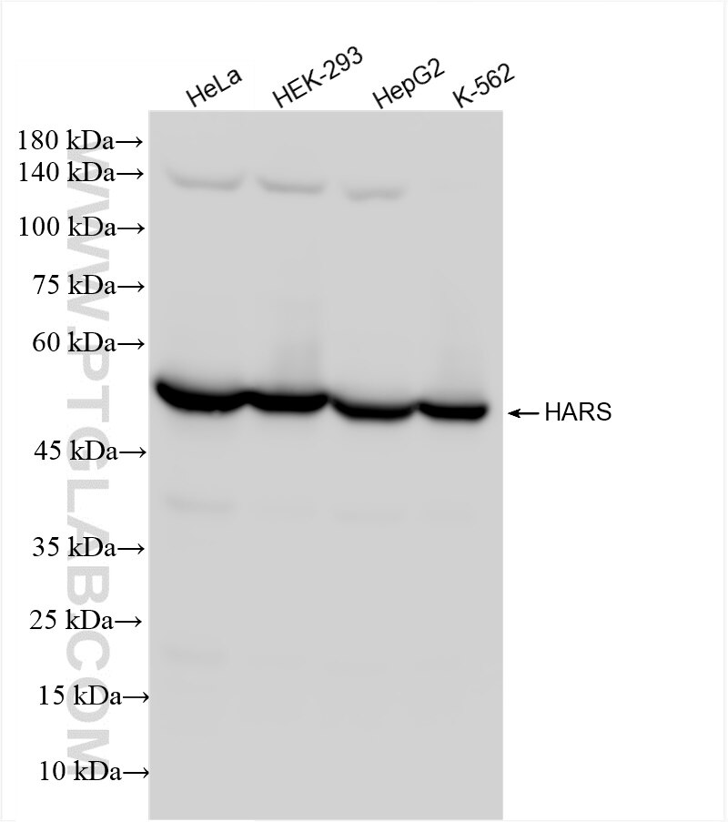 Western Blot (WB) analysis of various lysates using HARS Recombinant antibody (83497-3-RR)