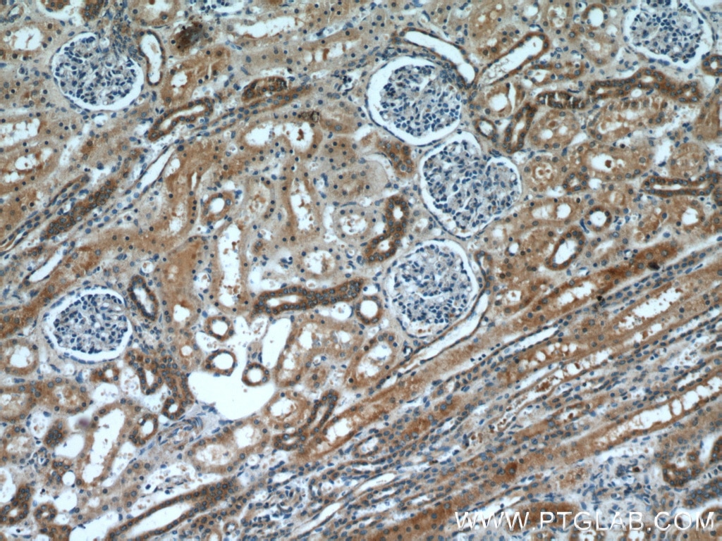 Immunohistochemistry (IHC) staining of human kidney tissue using HARS2 Polyclonal antibody (11301-1-AP)