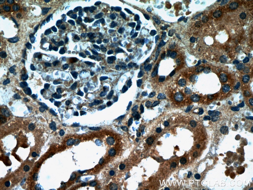 Immunohistochemistry (IHC) staining of human kidney tissue using HARS2 Polyclonal antibody (11301-1-AP)