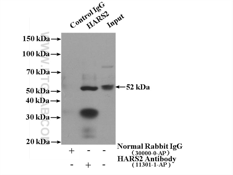 Immunoprecipitation (IP) experiment of HEK-293 cells using HARS2 Polyclonal antibody (11301-1-AP)