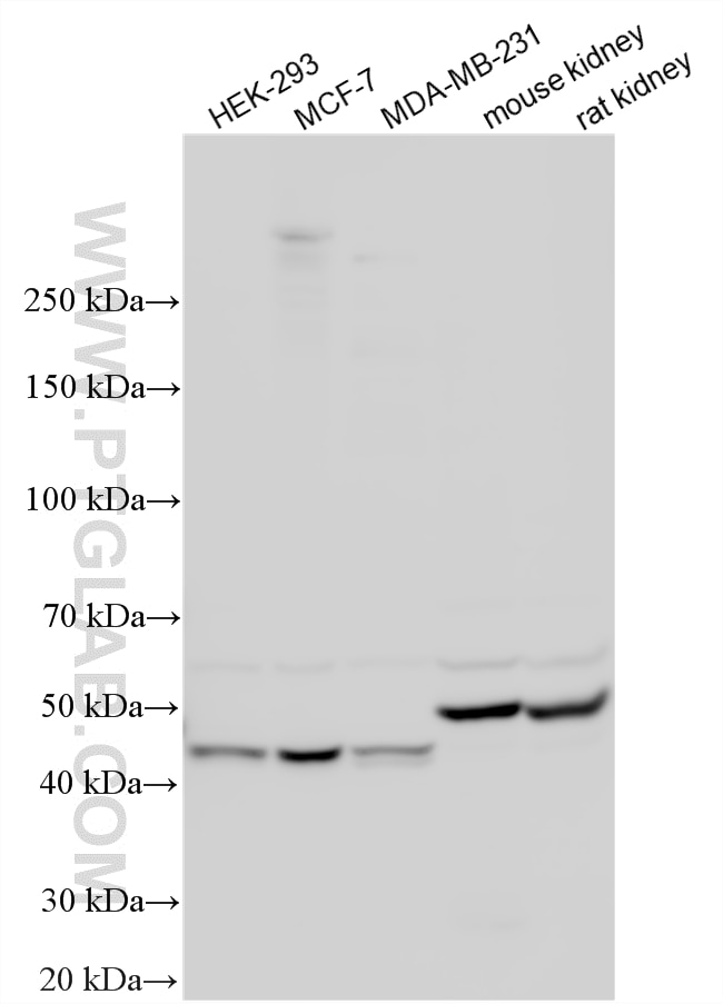 Various lysates were subjected to SDS PAGE followed by western blot with 11301-1-AP (HARS2 antibody) at dilution of 1:2000 incubated at room temperature for 1.5 hours. Western Blot (WB) analysis of various lysates using HARS2 Polyclonal antibody (11301-1-AP)