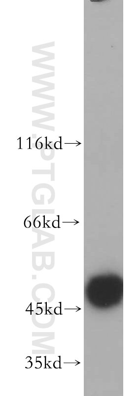 Western Blot (WB) analysis of HEK-293 cells using HARS2 Polyclonal antibody (11301-1-AP)