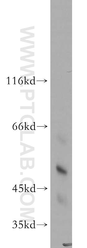 Western Blot (WB) analysis of human heart tissue using HARS2 Polyclonal antibody (11301-1-AP)