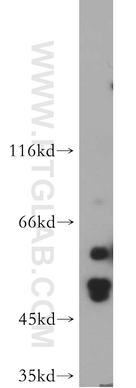 Western Blot (WB) analysis of MCF-7 cells using HARS2 Polyclonal antibody (11301-1-AP)