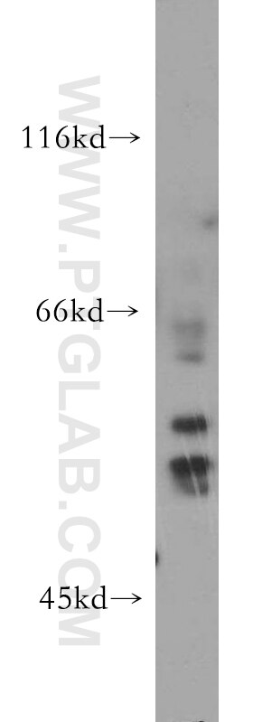 Western Blot (WB) analysis of mouse kidney tissue using HARS2 Polyclonal antibody (11301-1-AP)