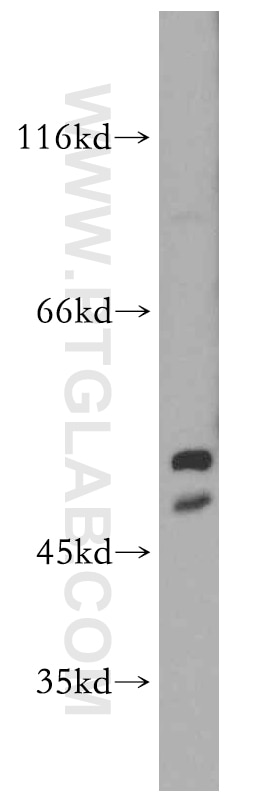 Western Blot (WB) analysis of MCF-7 cells using HARS2 Polyclonal antibody (11301-1-AP)