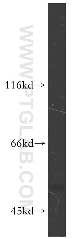 Western Blot (WB) analysis of HEK-293 cells using HARS2 Polyclonal antibody (11301-1-AP)