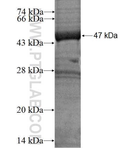 HARS2 fusion protein Ag1827 SDS-PAGE
