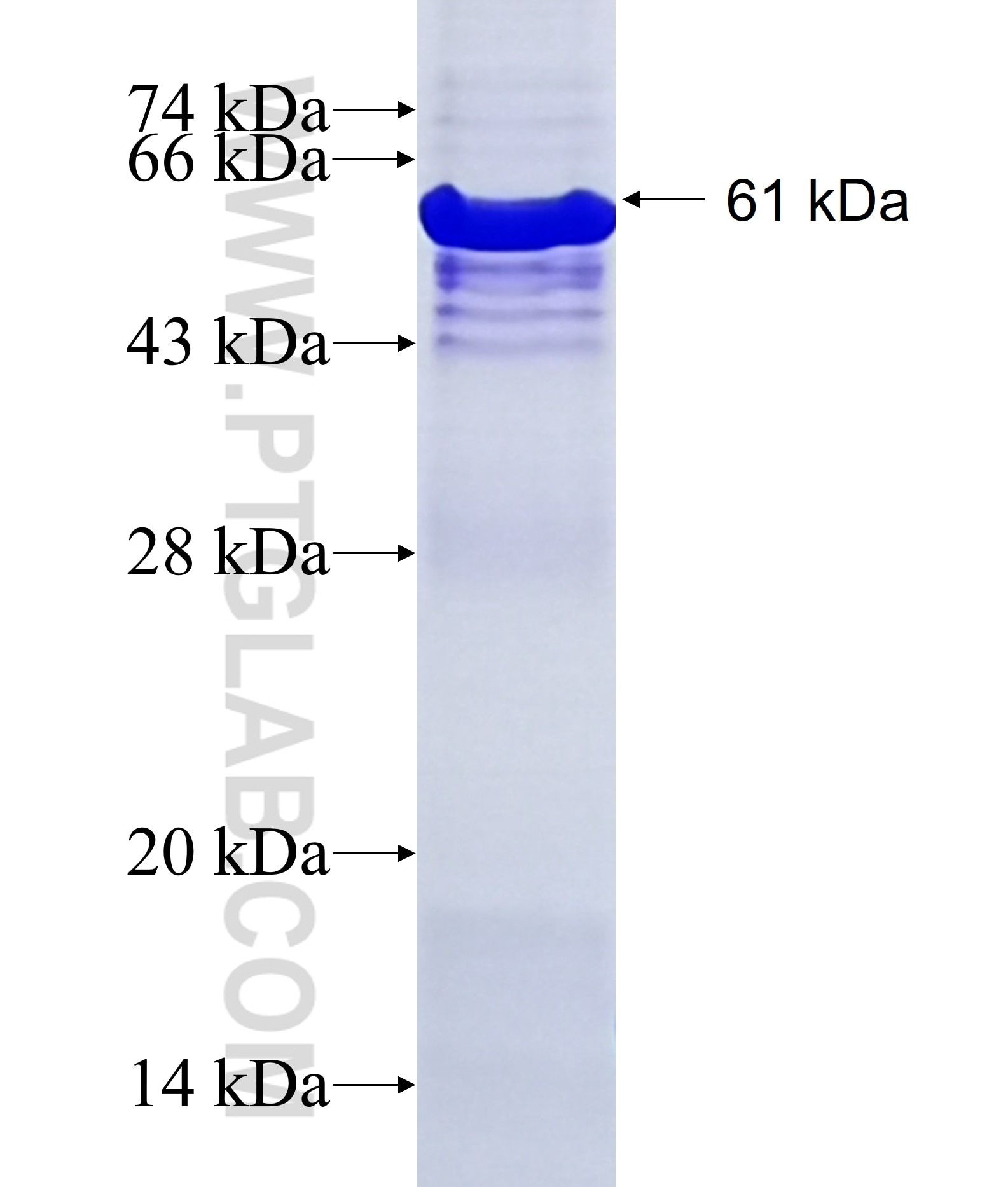 HARS2 fusion protein Ag1827 SDS-PAGE