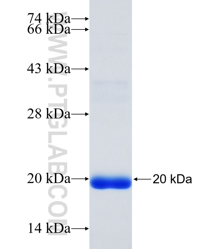 HAS2 fusion protein Ag34972 SDS-PAGE HAS2 fusion protein Ag34972 SDS-PAGE