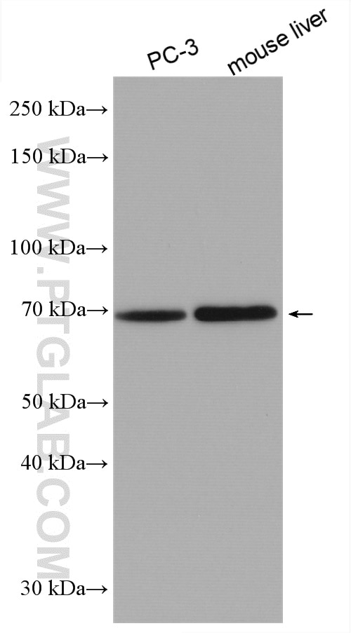 Western Blot (WB) analysis of various lysates using HAS3 Polyclonal antibody (15609-1-AP)