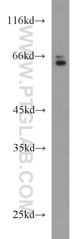 Western Blot (WB) analysis of L02 cells using HAS3 Polyclonal antibody (15609-1-AP)