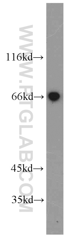 Western Blot (WB) analysis of mouse liver tissue using HAS3 Polyclonal antibody (15609-1-AP)