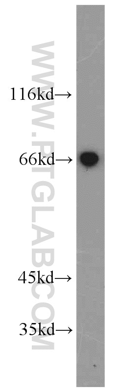 WB analysis of mouse liver using 15609-1-AP