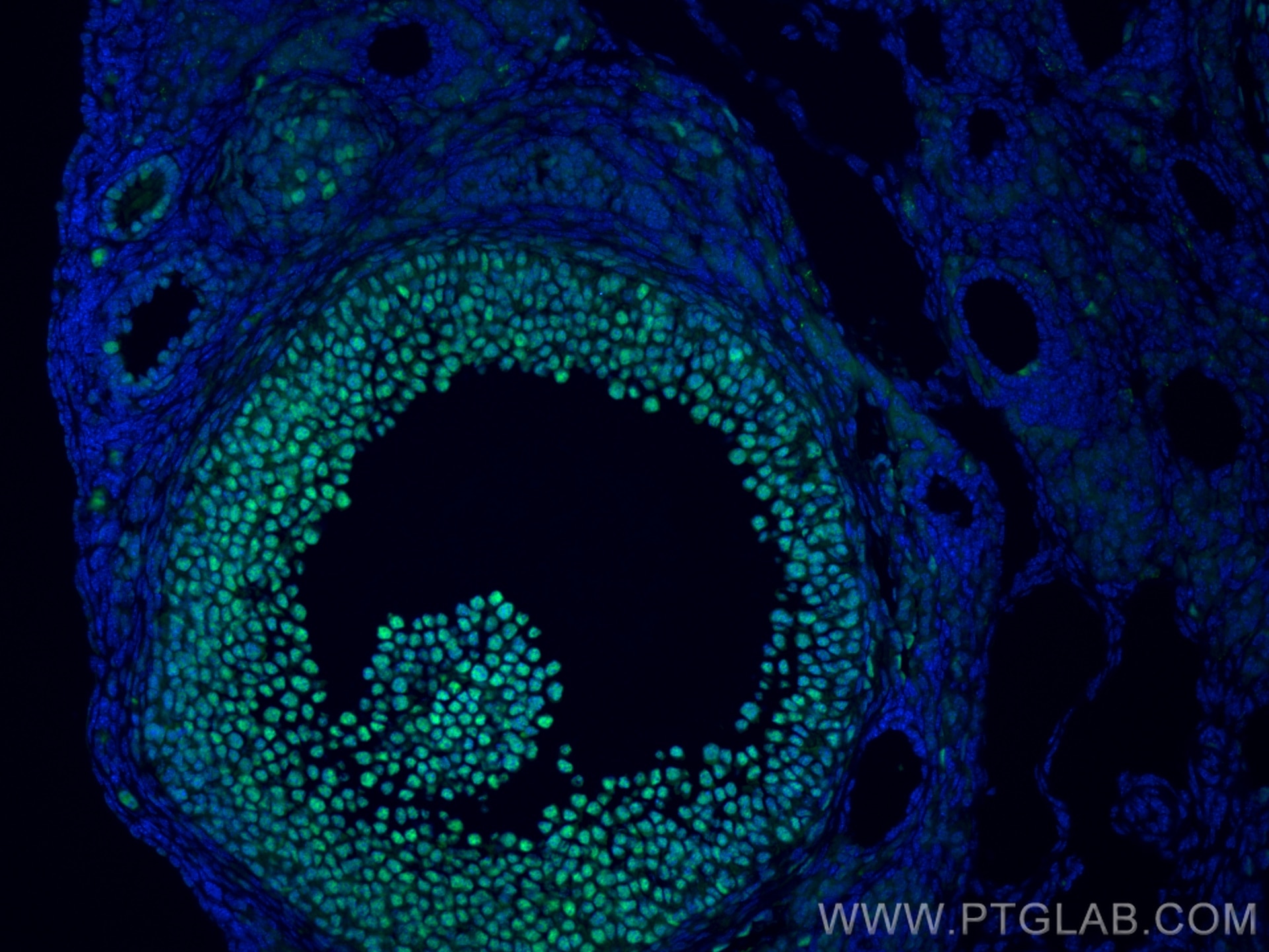 Immunofluorescence (IF) / fluorescent staining of mouse ovary tissue using HAT1 Polyclonal antibody (11432-1-AP)
