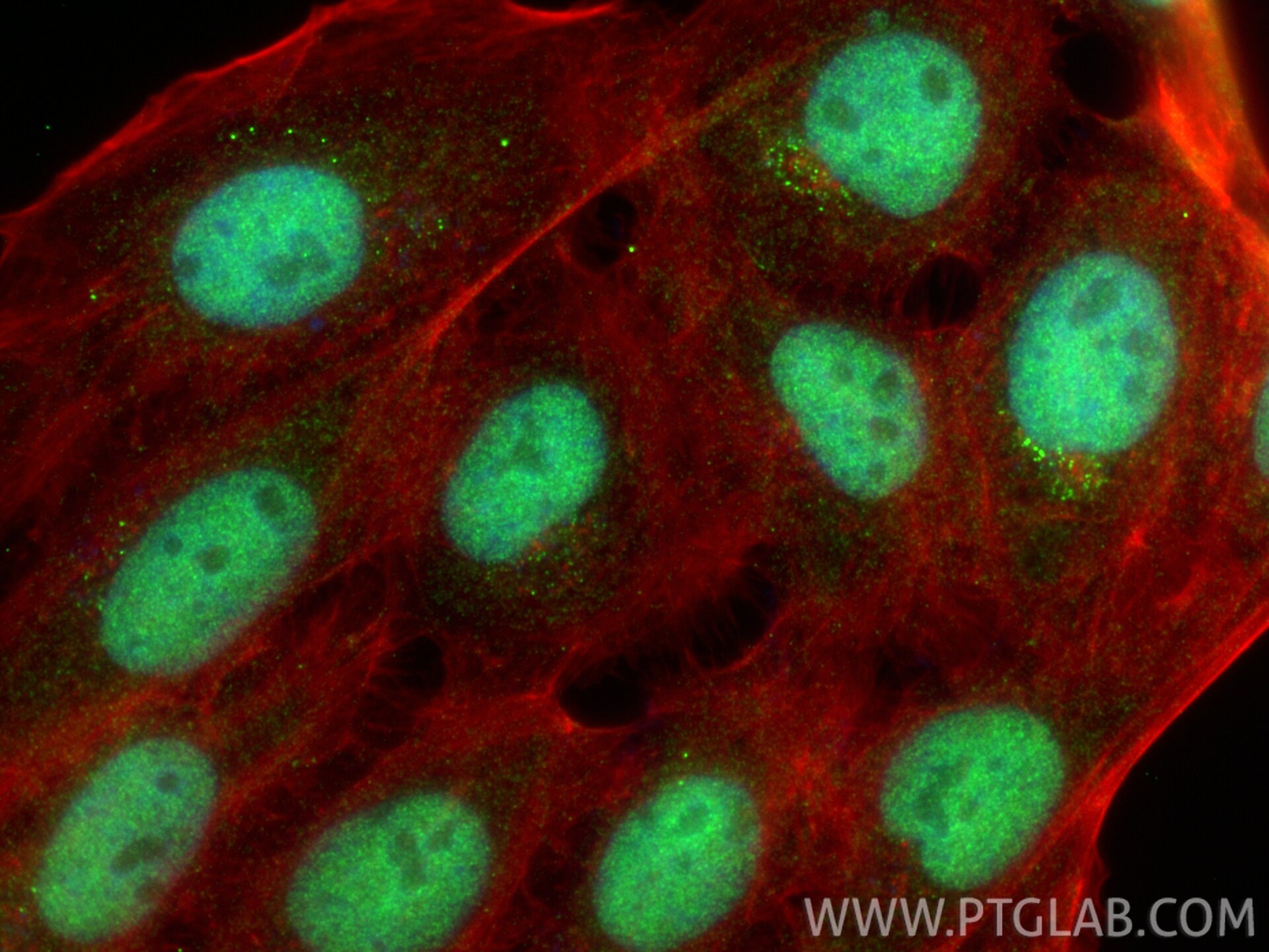 IF Staining of A431 using 11432-1-AP Immunofluorescence (IF) / fluorescent staining of A431 cells using HAT1 Polyclonal antibody (11432-1-AP)