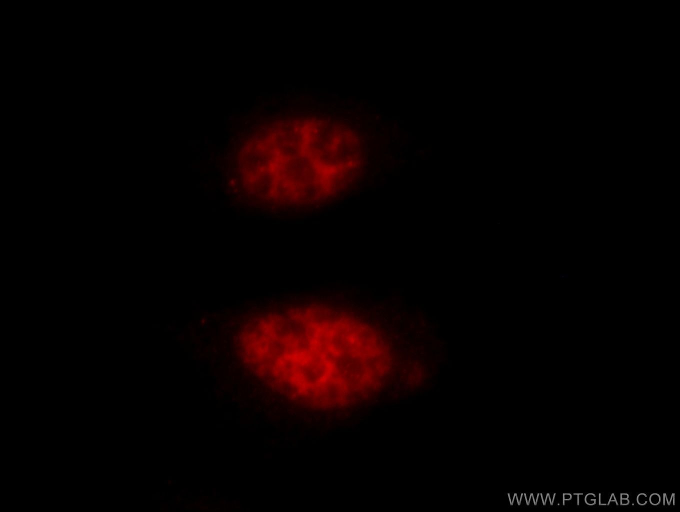 Immunofluorescence (IF) / fluorescent staining of HepG2 cells using HAT1 Polyclonal antibody (11432-1-AP)