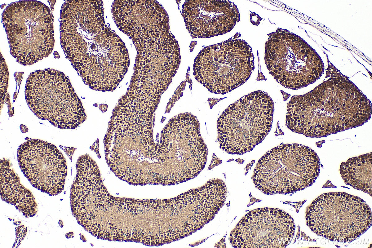 Immunohistochemical analysis of paraffin-embedded mouse testis tissue slide using 11432-1-AP (HAT1 antibody) at dilution of 1:500 (under 10x lens). Heat mediated antigen retrieval with Tris-EDTA buffer (pH 9.0). Immunohistochemistry (IHC) staining of mouse testis tissue using HAT1 Polyclonal antibody (11432-1-AP)