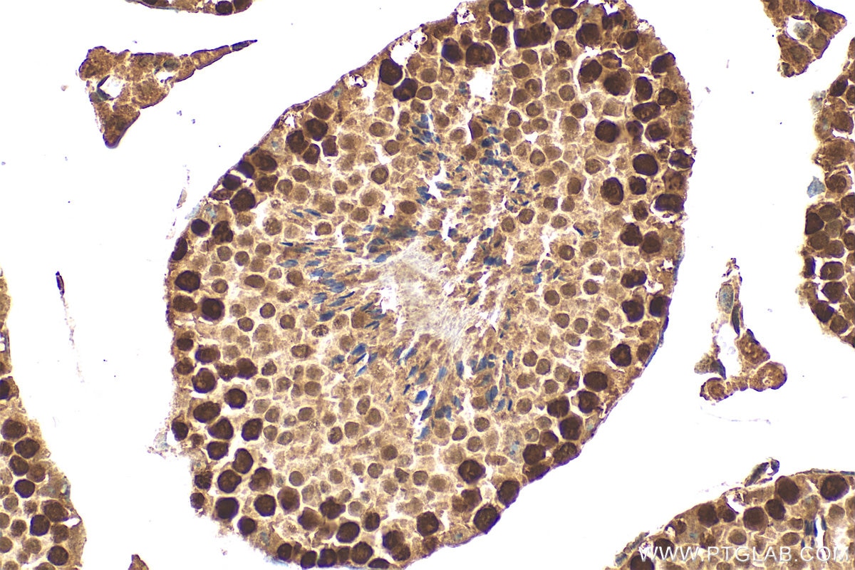 Immunohistochemical analysis of paraffin-embedded mouse testis tissue slide using 11432-1-AP (HAT1 antibody) at dilution of 1:500 (under 40x lens). Heat mediated antigen retrieval with Tris-EDTA buffer (pH 9.0). Immunohistochemistry (IHC) staining of mouse testis tissue using HAT1 Polyclonal antibody (11432-1-AP)