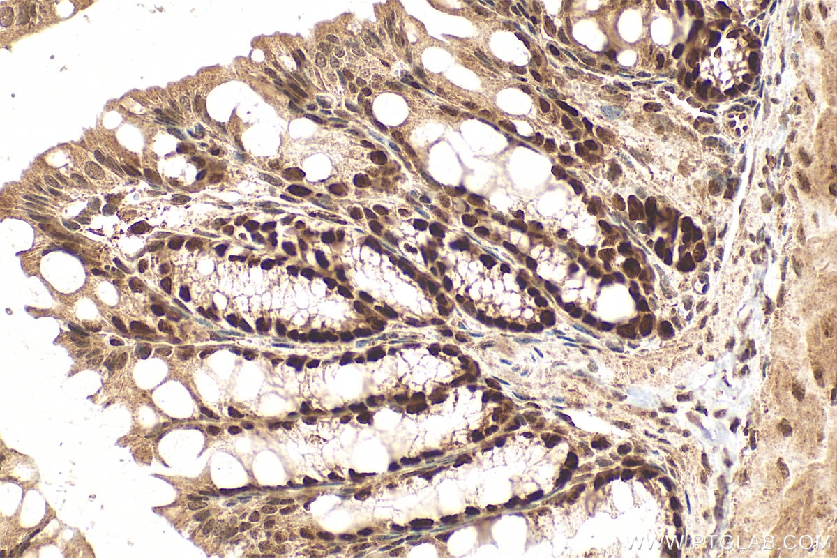 IHC staining of mouse colon using 11432-1-AP Immunohistochemistry (IHC) staining of mouse colon tissue using HAT1 Polyclonal antibody (11432-1-AP)