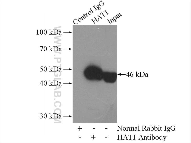 Immunoprecipitation (IP) experiment of HepG2 cells using HAT1 Polyclonal antibody (11432-1-AP)
