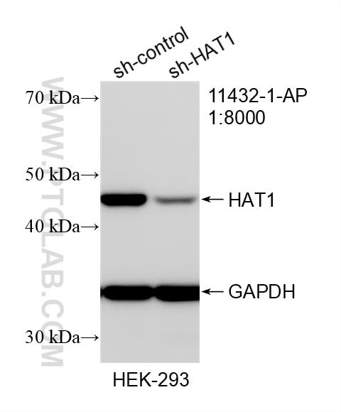 Western Blot (WB) analysis of HEK-293 cells using HAT1 Polyclonal antibody (11432-1-AP)