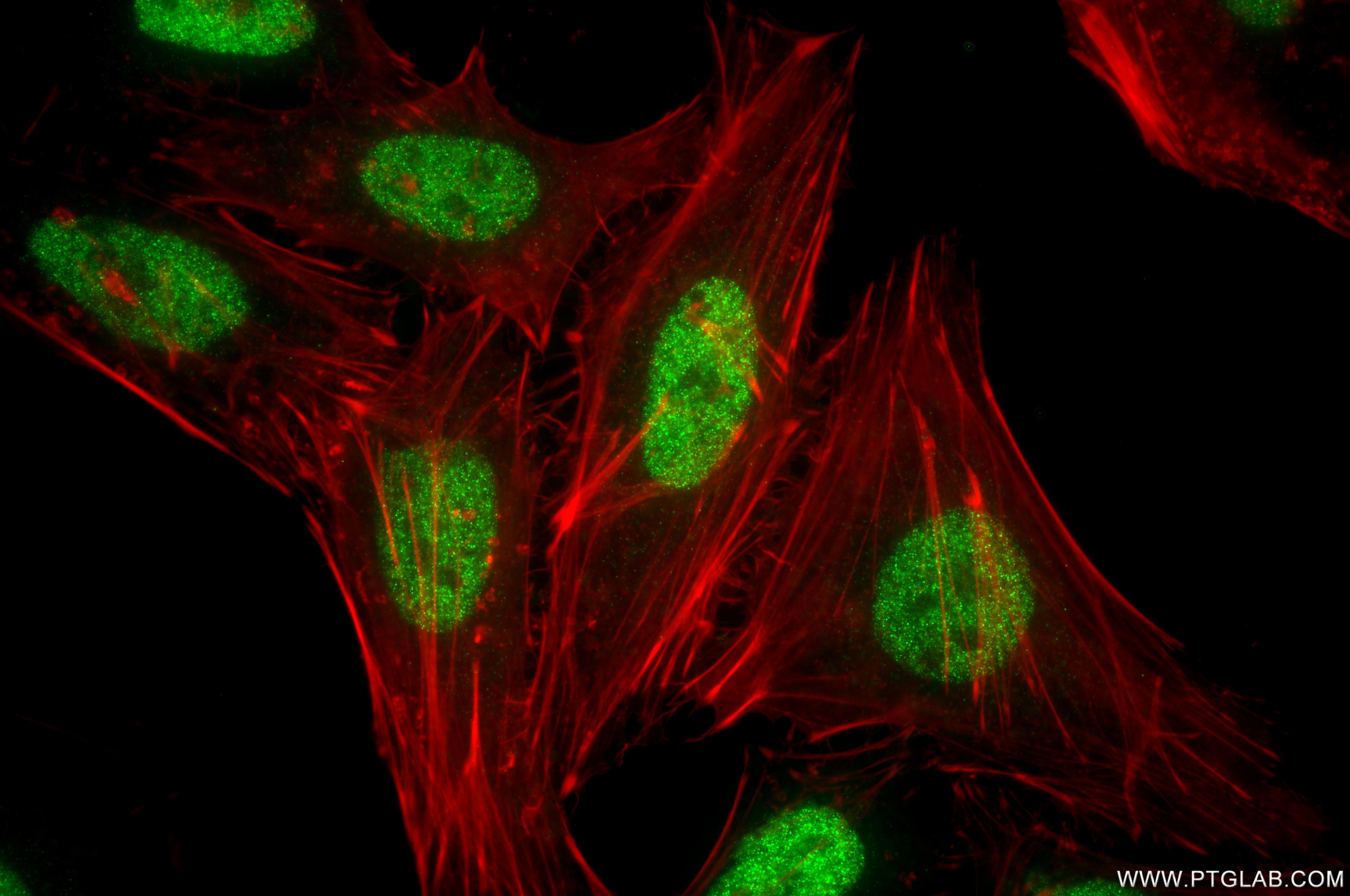 Immunofluorescence (IF) / fluorescent staining of HeLa cells using HAT1 Recombinant monoclonal antibody (86815-1-RR)