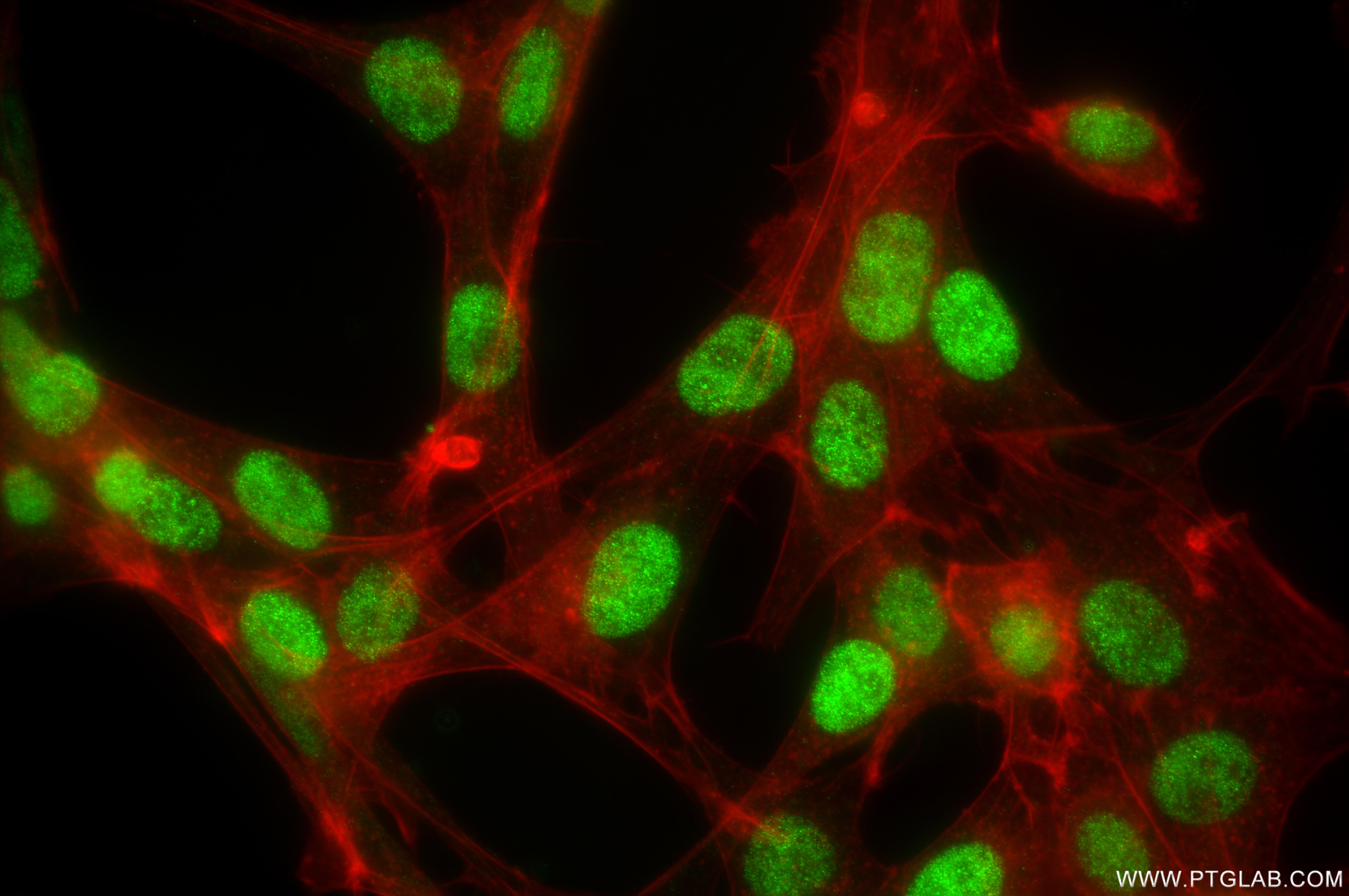 Immunofluorescence (IF) / fluorescent staining of NIH/3T3 cells using HAT1 Recombinant monoclonal antibody (86815-1-RR)