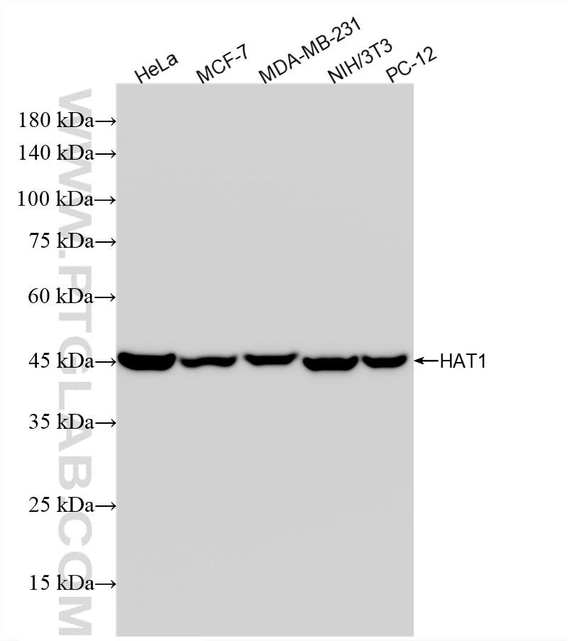 Western Blot (WB) analysis of various lysates using HAT1 Recombinant monoclonal antibody (86815-1-RR)