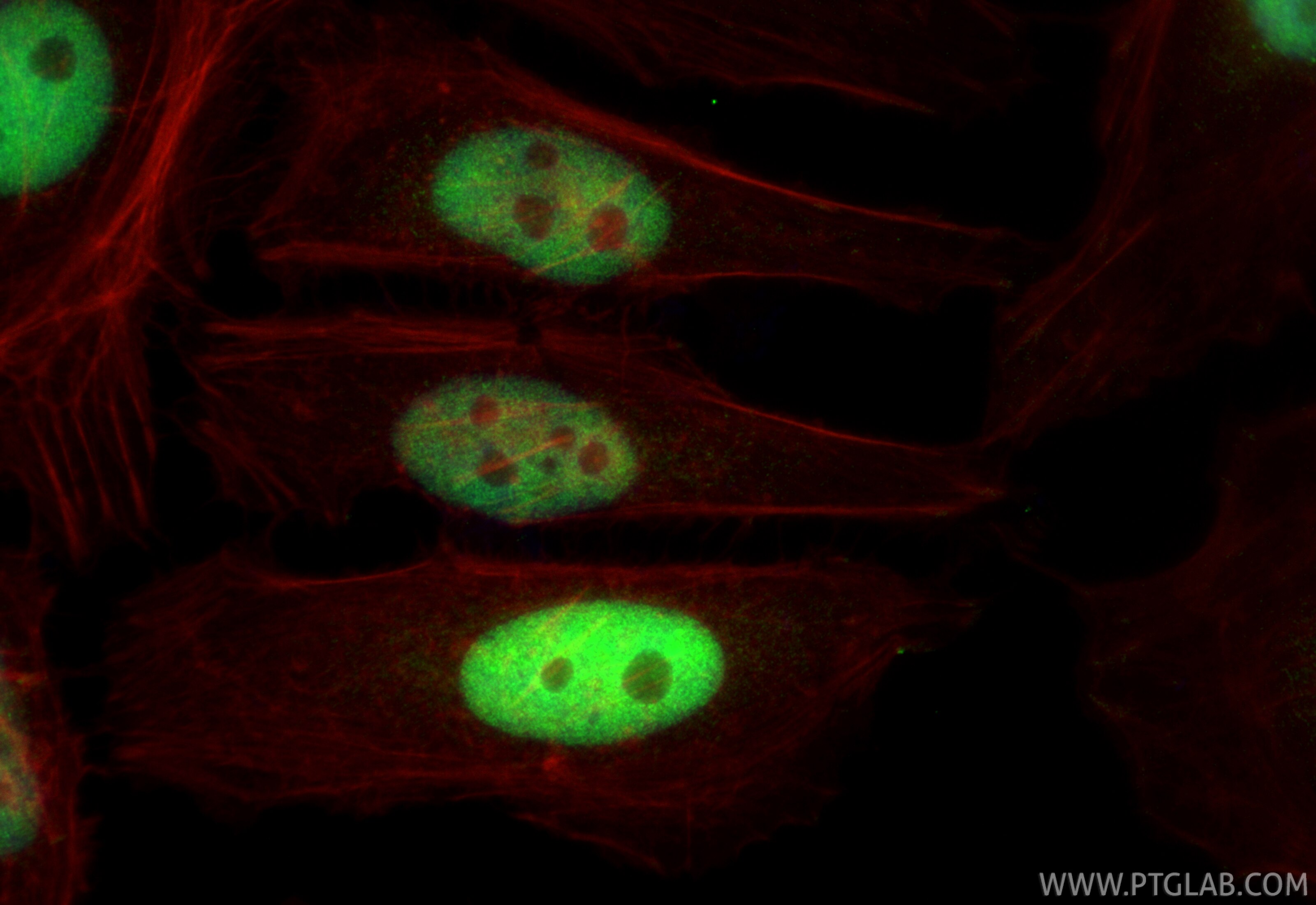 IF Staining of HeLa using RMX00092 Immunofluorescence (IF) / fluorescent staining of HeLa cells using Multi-rAb® HAT1 Multi-Recombinant antibody (RMX00092)