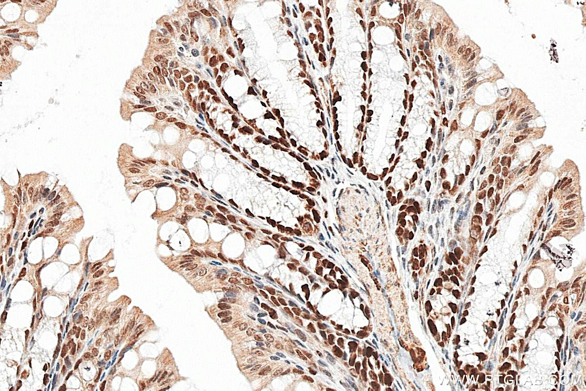 IHC staining of mouse colon using RMX00092 Immunohistochemistry (IHC) staining of mouse colon tissue using Multi-rAb® HAT1 Multi-Recombinant antibody (RMX00092)