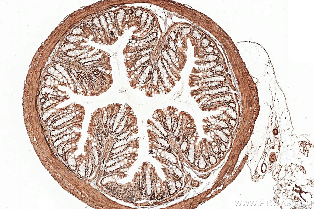 IHC staining of mouse colon using RMX00092 Immunohistochemistry (IHC) staining of mouse colon tissue using Multi-rAb® HAT1 Multi-Recombinant antibody (RMX00092)