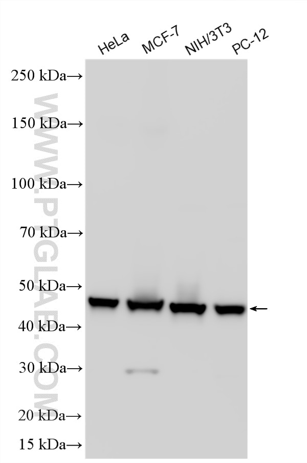 WB analysis using RMX00092 Western Blot (WB) analysis of various lysates using Multi-rAb® HAT1 Multi-Recombinant antibody (RMX00092)
