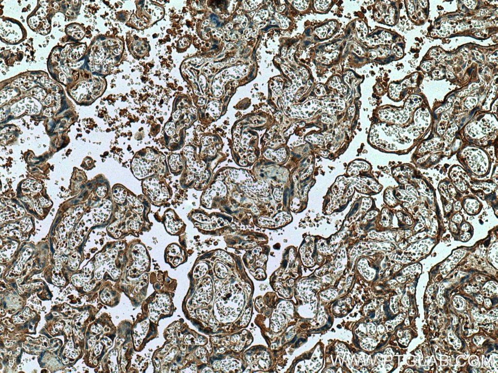 Immunohistochemistry (IHC) staining of human placenta tissue using HAUS4 Polyclonal antibody (20104-1-AP)