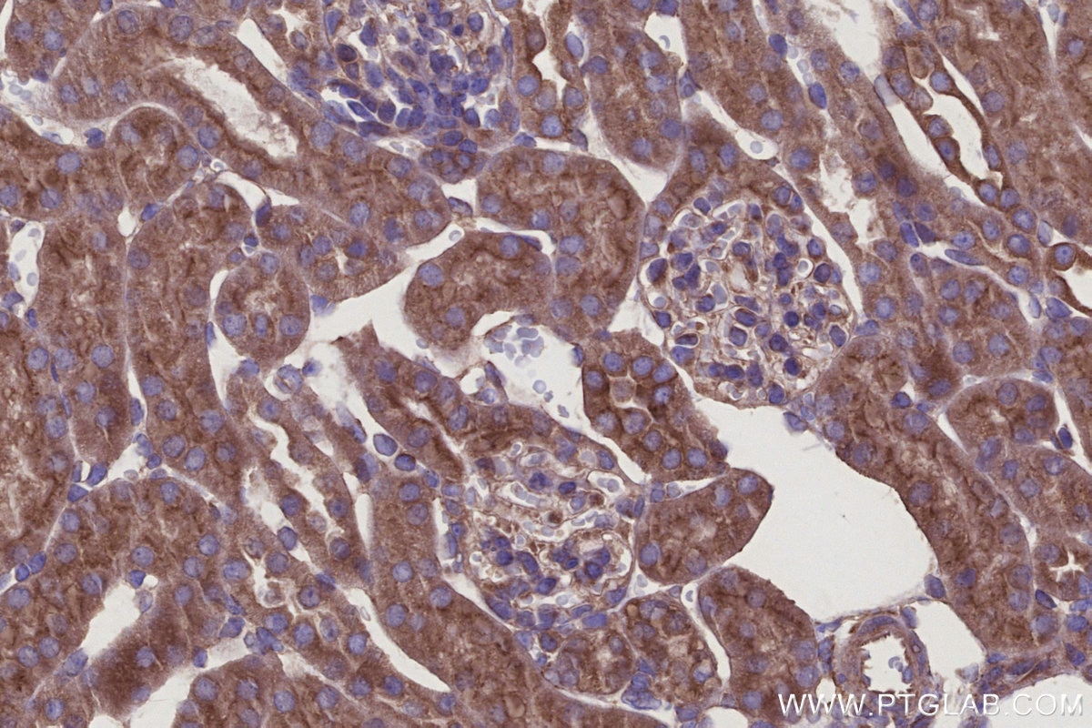 Immunohistochemistry (IHC) staining of mouse kidney tissue using HAUS4 Polyclonal antibody (20104-1-AP)