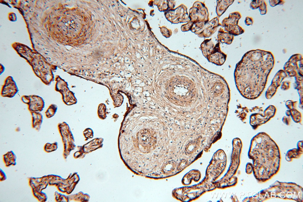 Immunohistochemistry (IHC) staining of human placenta tissue using HAUS4 Polyclonal antibody (20104-1-AP)